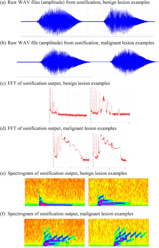 Medical Sonification
